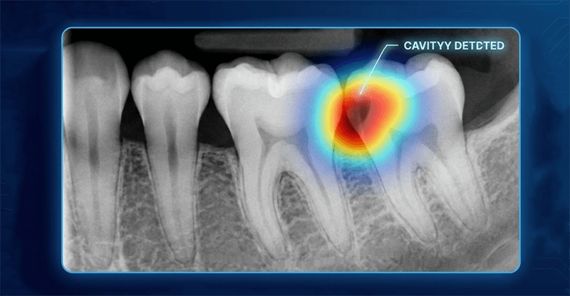 The Automated Second Opinion